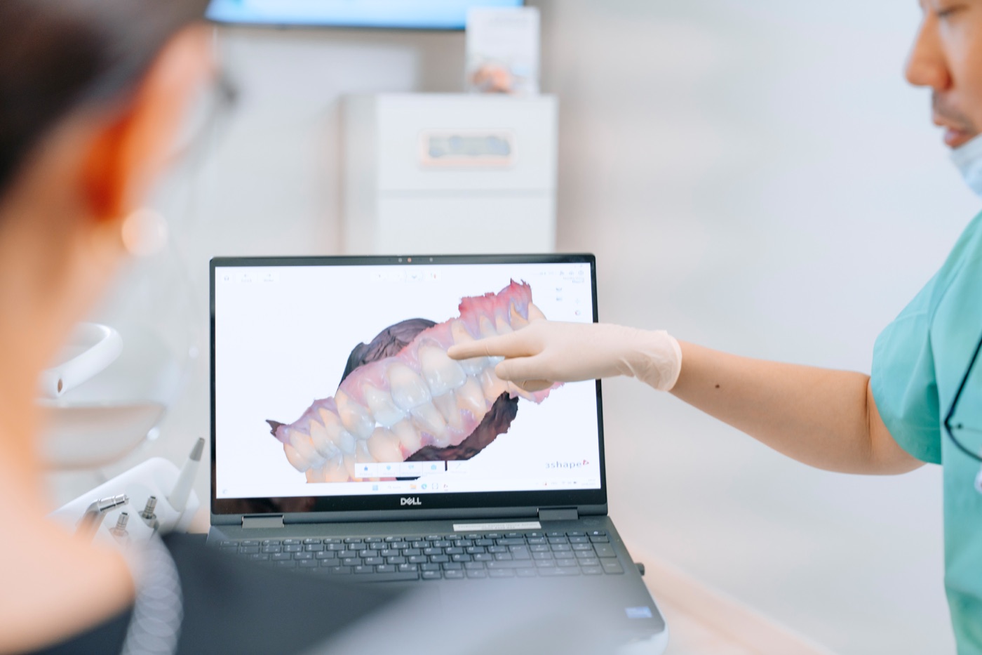 Digitaler Intraoralscan am Bildschirm